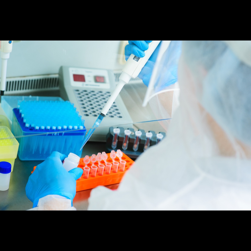 Spring viraemia of carp virus One step Real Time qPCR kit size: 100 reactions