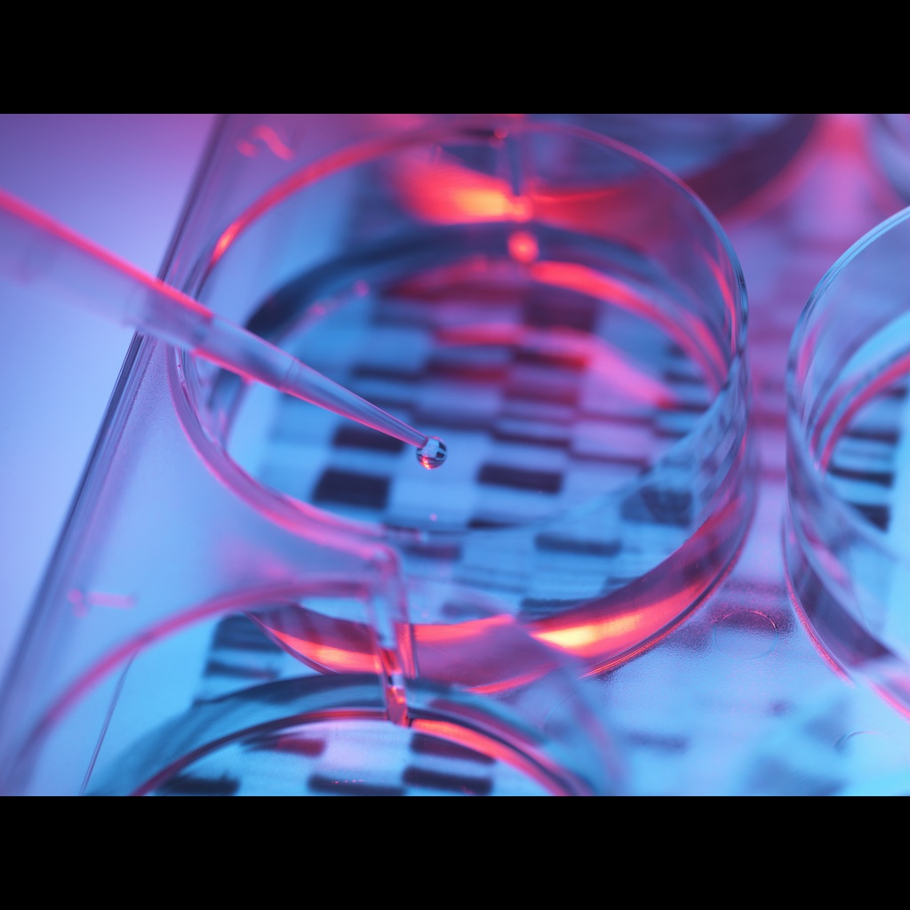 Recombinant Deoxyribonuclease I  (DNase I, RNase-free) (2 U/μL)-1000 U