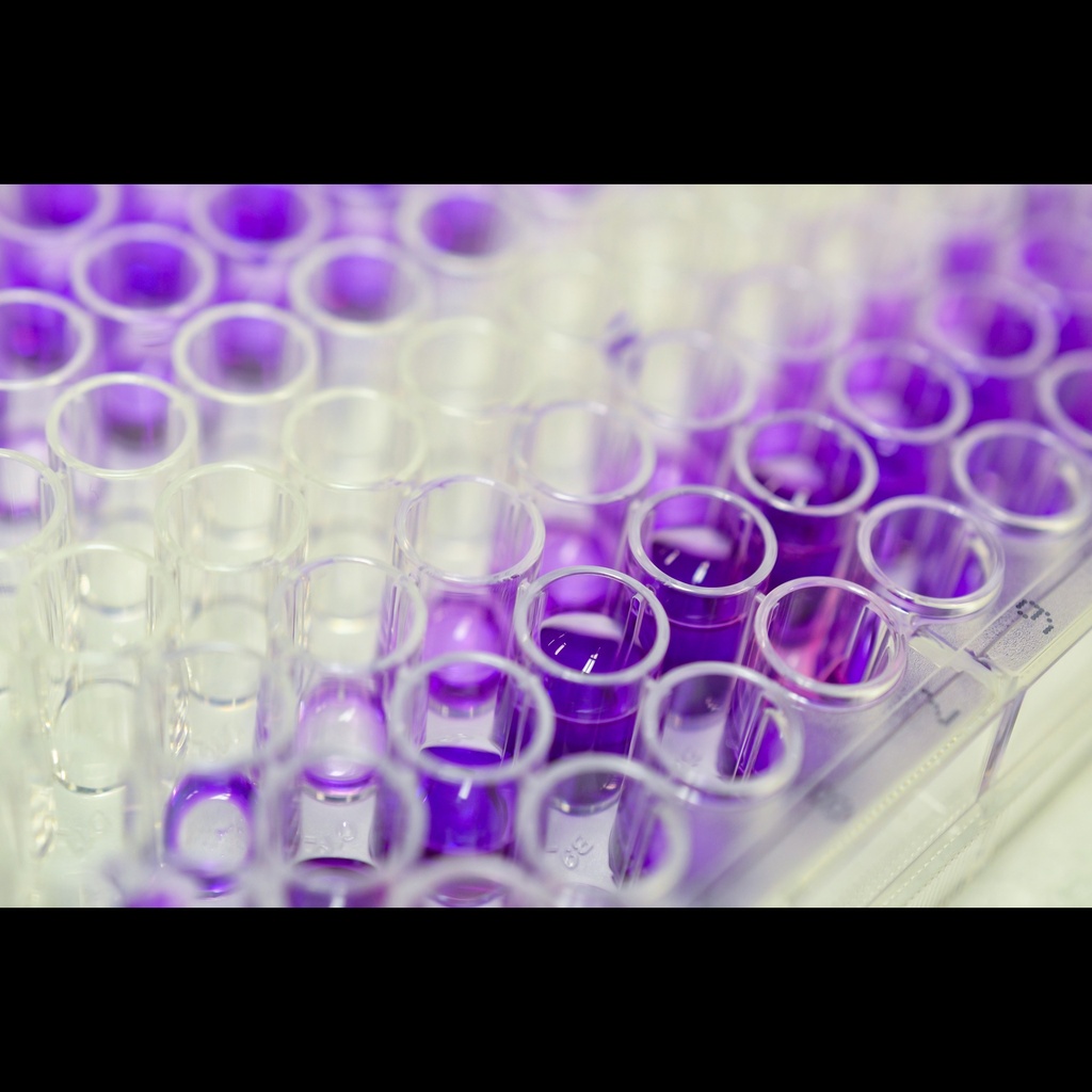 Human Antisize:Keyhole limpet hemocyanin  KLH  IgG ELISA Kit size: 96 tests